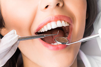 Periodontal Surgery in Pleasant Grove